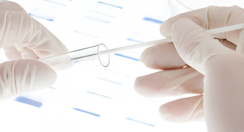 Caso Ungari, nuova istanza: DNA e reperti sotto esame